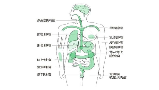 Mfumo wa AI Epic Co-Ablation1