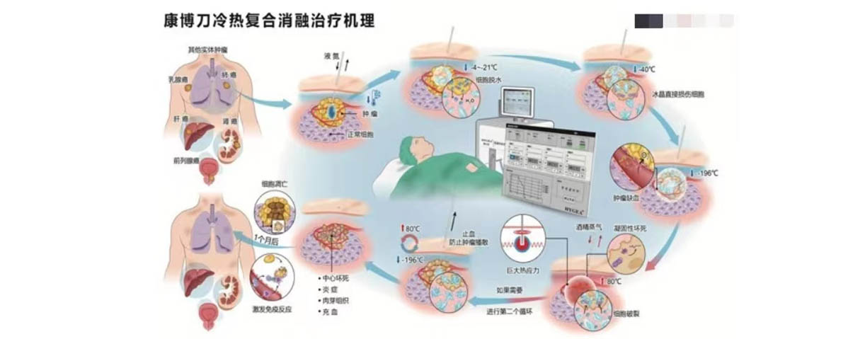 AI Epic Co-Ablation