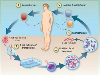 CAR-T Treatment for Cancer9