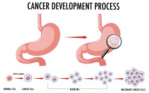 Diagram showing normal and cancer cells in human